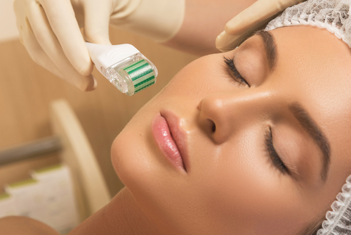  Face microneedling treatment with a meso roller