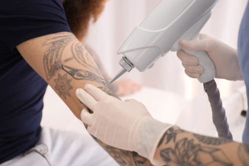 Cosmetologist with patient and professional tattoo removal laser in salon